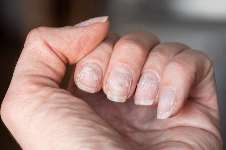 08 Dicas para fortalecer as unhas quebradiças em casa