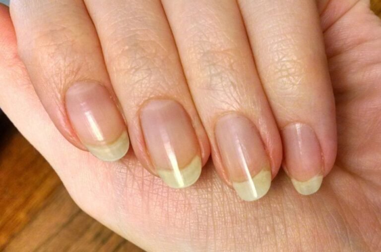 Como clarear as unhas amarelas em casa de forma segura
