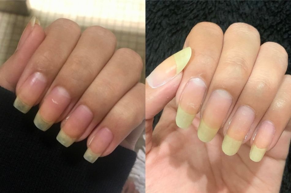 Como prevenir o amarelado nas unhas