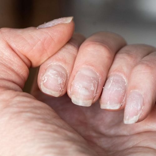 08 Dicas para fortalecer as unhas quebradiças em casa