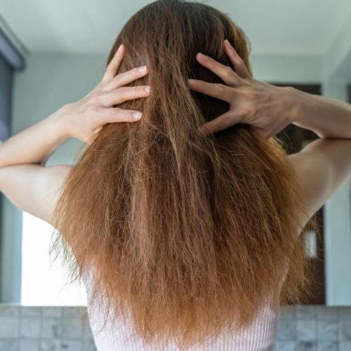 Cabelos ressecados precisam de cuidados simples que você ainda não faz